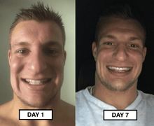 Load image into Gallery viewer, Snow® At-Home Teeth Whitening Kit