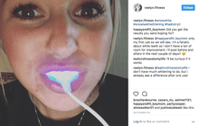 Load image into Gallery viewer, SISTEMA EM CASA SNOW TEETH WHITENING™ [‘KIT’ COMPLETO]
