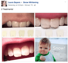 Load image into Gallery viewer, SNOW TEETH WHITENING™ ZAHNWEISS-SYSTEM FÜR ZUHAUSE [ALL-IN-ONE KIT]
