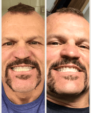 Load image into Gallery viewer, Snow® Teeth Whitening At-Home System [For SweatCoin]
