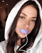 Load image into Gallery viewer, SNOW TEETH WHITENING™ ZAHNWEISS-SYSTEM FÜR ZUHAUSE [ALL-IN-ONE KIT]
