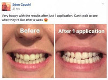 Load image into Gallery viewer, Special Offer - SNOW Teeth Whitening™ System
